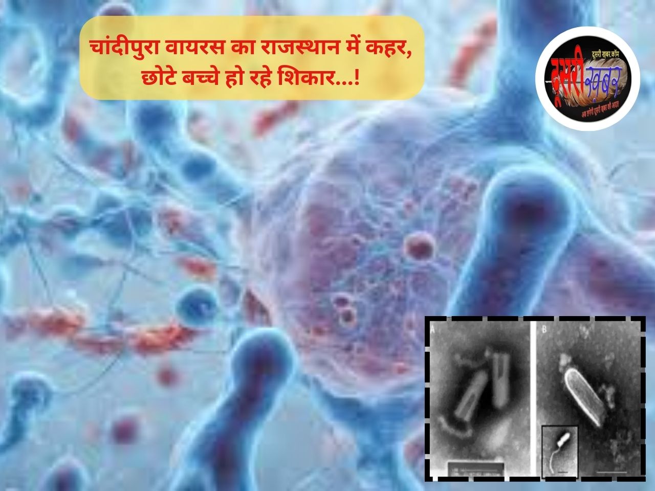 चांदीपुरा वायरस बच्चों के लिए क्यों खतरनाक, उदयपुर में 2 बच्चे चपेट में