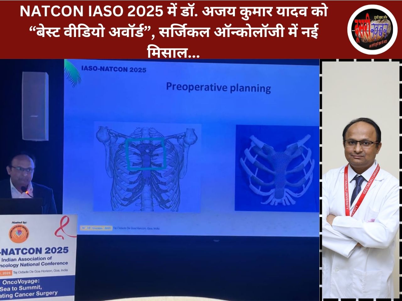 NATCON IASO 2025 में डॉ. अजय कुमार यादव को “बेस्ट वीडियो अवॉर्ड”, सर्जिकल ऑन्कोलॉजी में नई मिसाल…