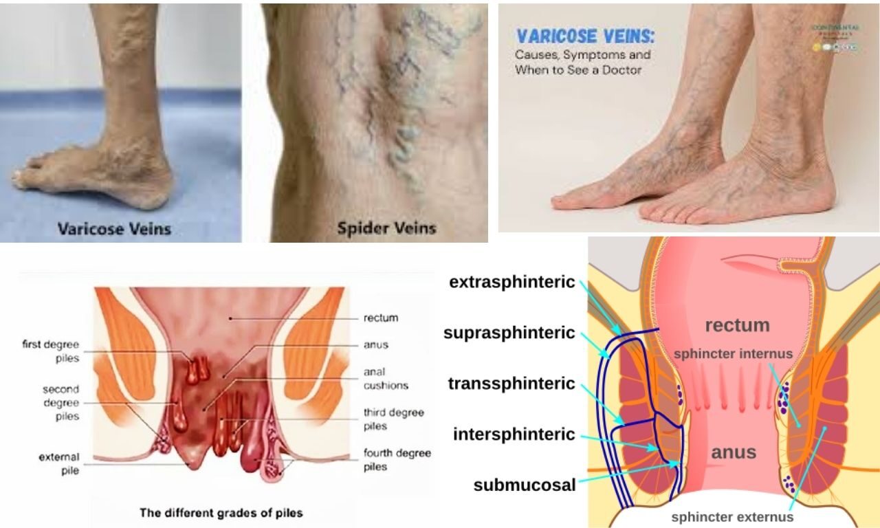 गीतांजली हॉस्पिटल उदयपुर, लेज़र सर्जरी वर्कशॉप, लेज़र सर्जरी लाइव डेमो, जनरल सर्जरी प्रशिक्षण, आधुनिक सर्जरी तकनीक