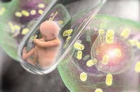 प्रीटर्म शिशु