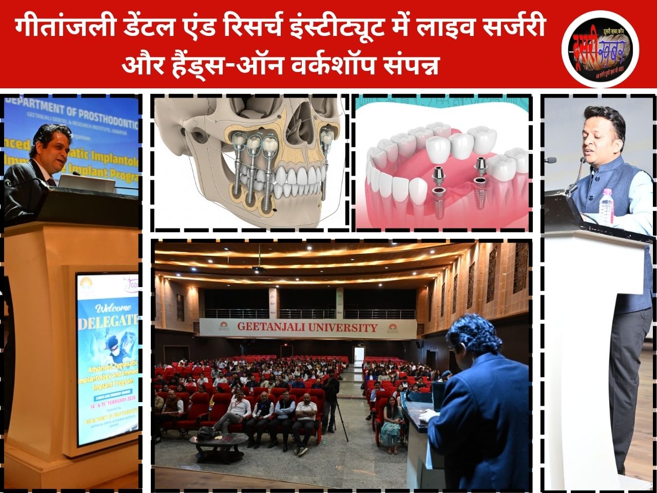 उदयपुर में एडवांस्ड ज़ायगोमैटिक इम्प्लांटोलॉजी का राष्ट्रीय संगोष्ठी