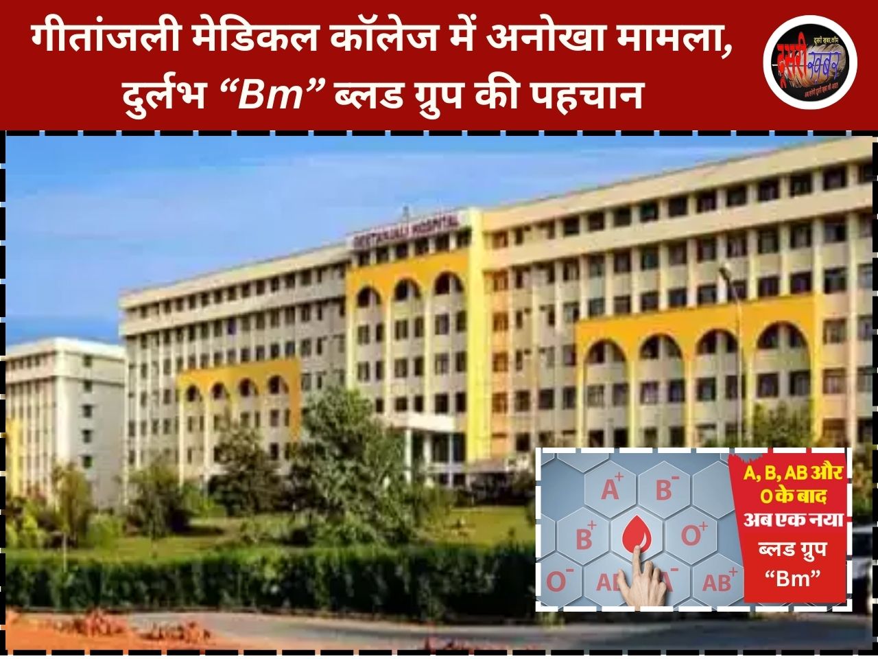 गीतांजली मेडिकल कॉलेज में अनोखा मामला, दुर्लभ “Bm” ब्लड ग्रुप की पहचान