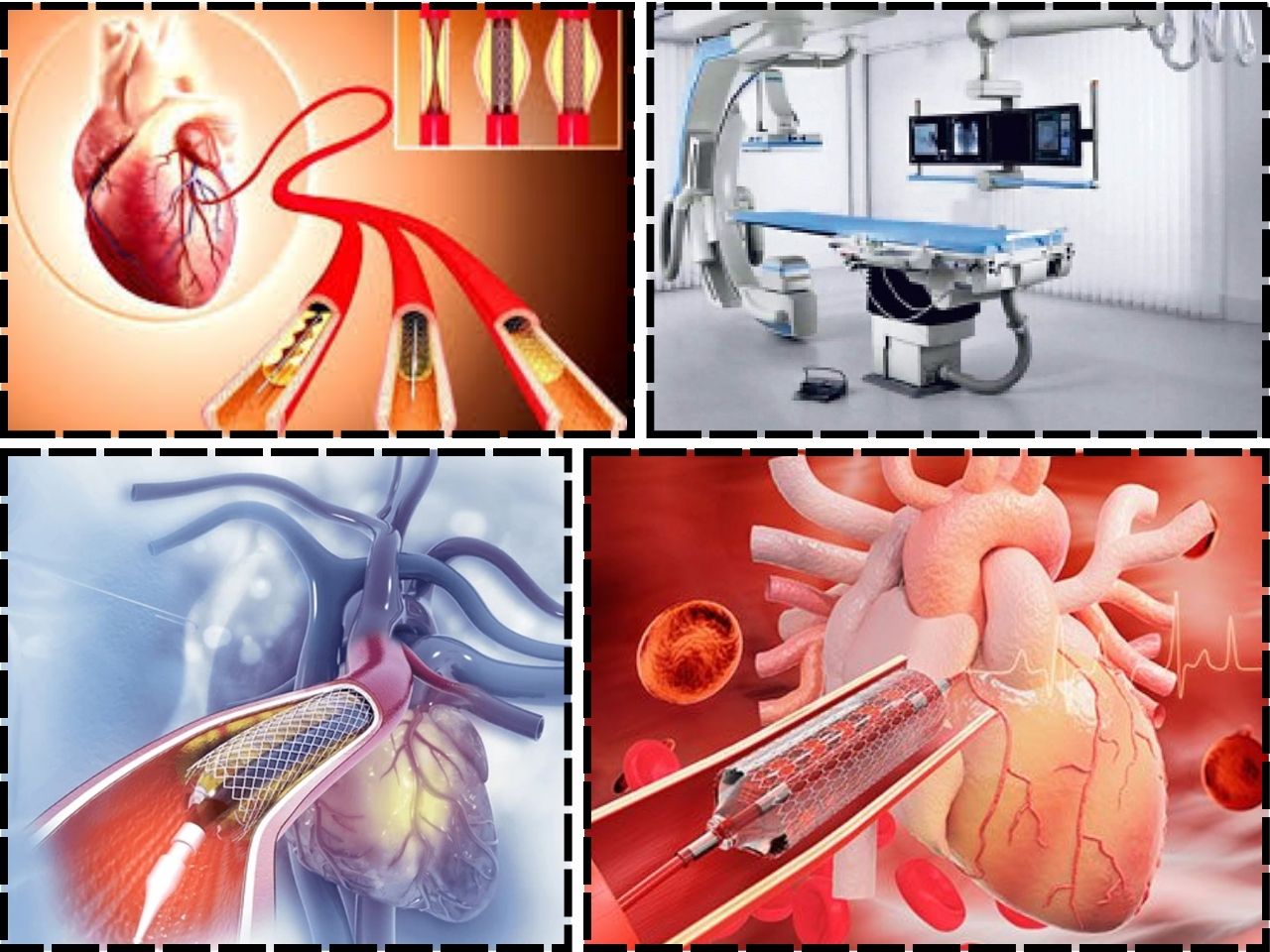 गीतांजली अस्पताल में हाइब्रिड तकनीक से जटिल हार्ट सर्जरी सफल, 73 वर्षीय मरीज को नई जिंदगी