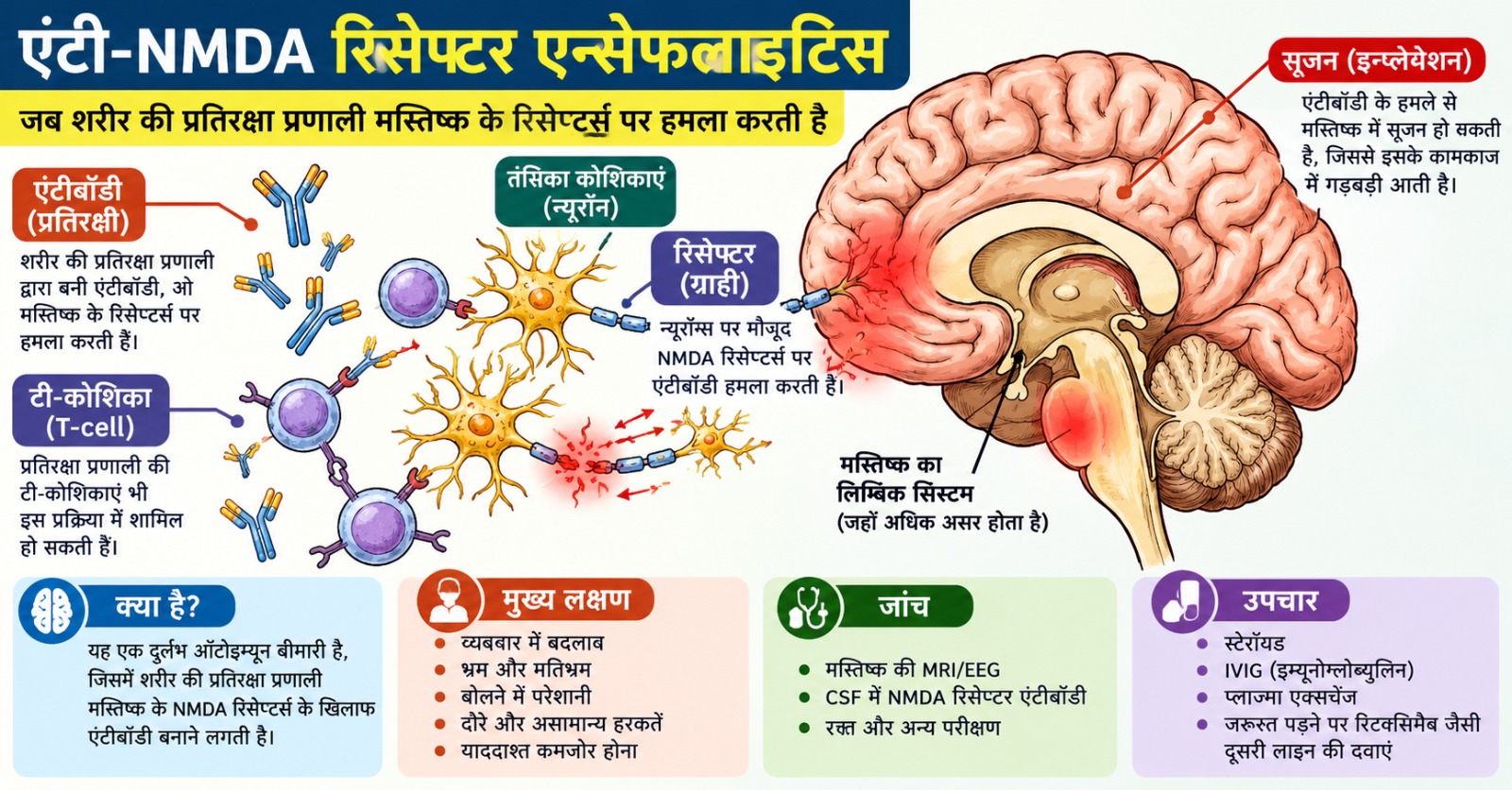टी-NMDA रिसेप्टर एन्सेफलाइटिस